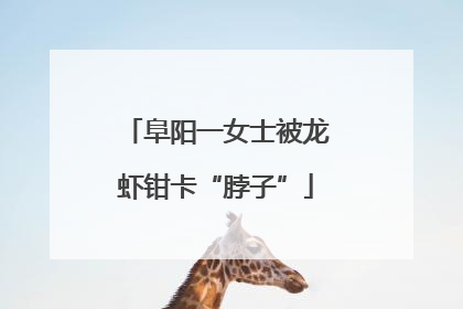 阜阳一女士被龙虾钳卡“脖子”